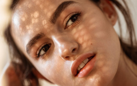 Amazin U - Chemical Peels