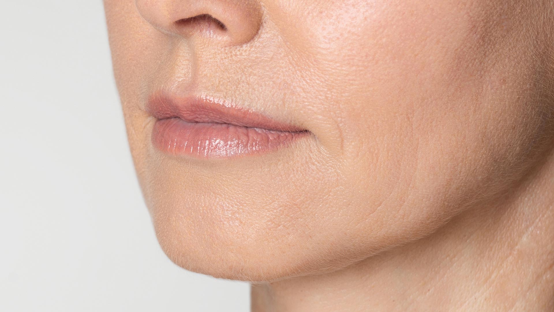 Amazin U - Gummy Smile