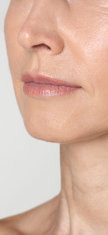 Amazin U - Gummy Smile