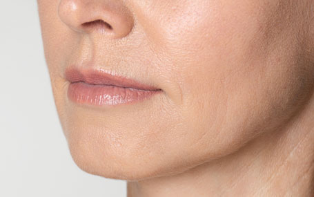 Amazin U - Gummy Smile