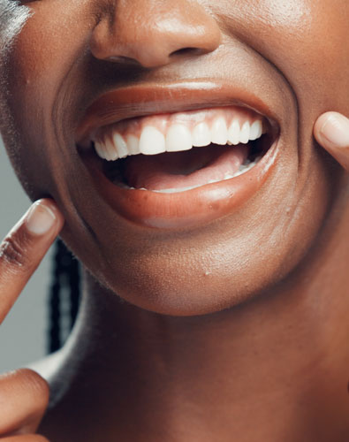 Amazin U - Gummy Smile What Is