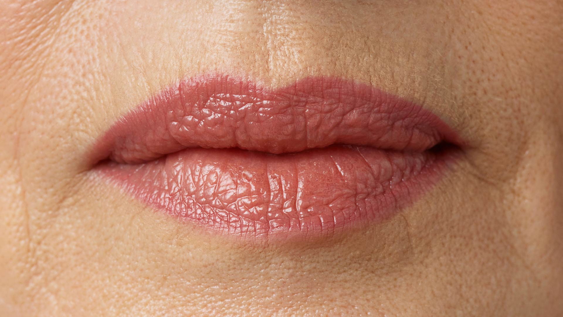 Amazin U - Lip Dehydration & Volume Loss