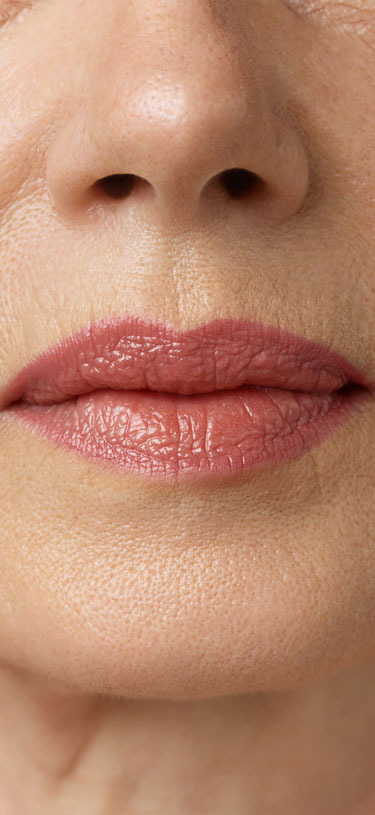 Amazin U - Lip Dehydration & Volume Loss