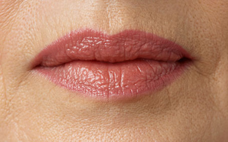 Amazin U - Lip Dehydration & Volume Loss