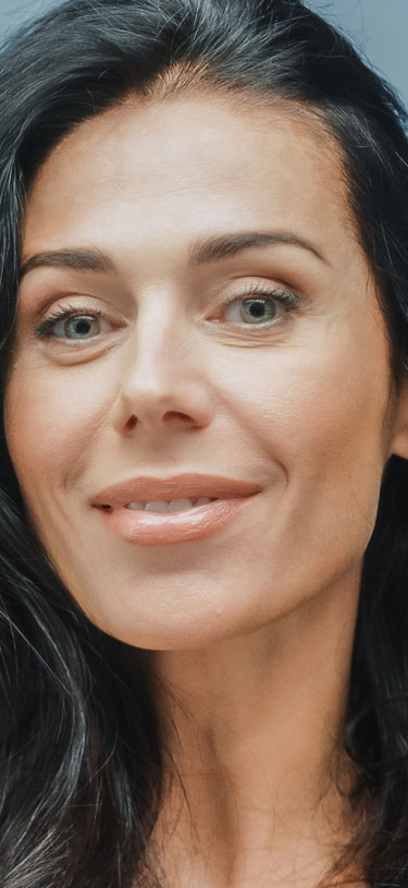 Amazin U - Nasolabial Folds & Marionette Lines