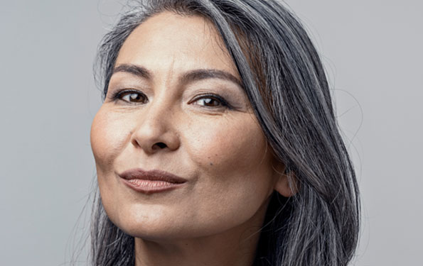 Amazin U - Nasolabial Folds & Marionette Lines What Causes