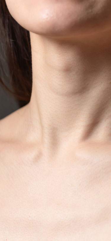 Amazin U - Nefertiti Neck Lift (Platysma Bands)