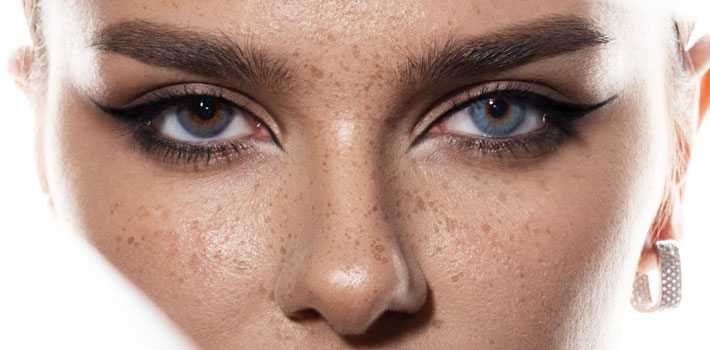 Amazin U - Non Surgical Nose Job How Does It Work