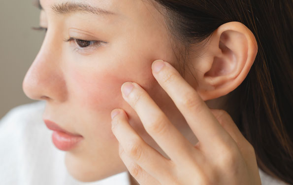 Amazin U - Rosacea & Facial Redness What Causes