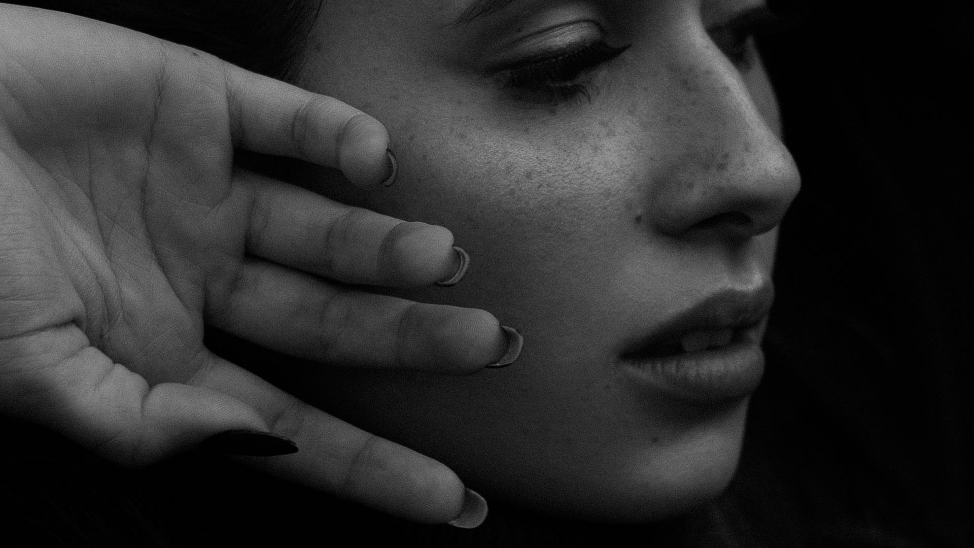 Amazin U - Cheek Filler Treatment