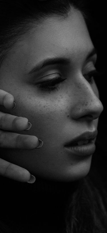 Amazin U - Cheek Filler Treatment