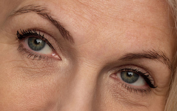 Amazin U - Crow’s Feet What Causes