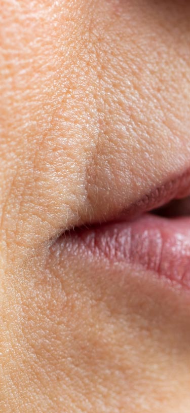 Amazin U - Downturned Mouth Corners