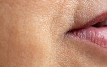 Amazin U - Downturned Mouth Corners