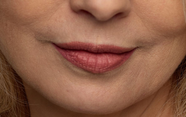 Amazin U - Downturned Mouth Corners What Is