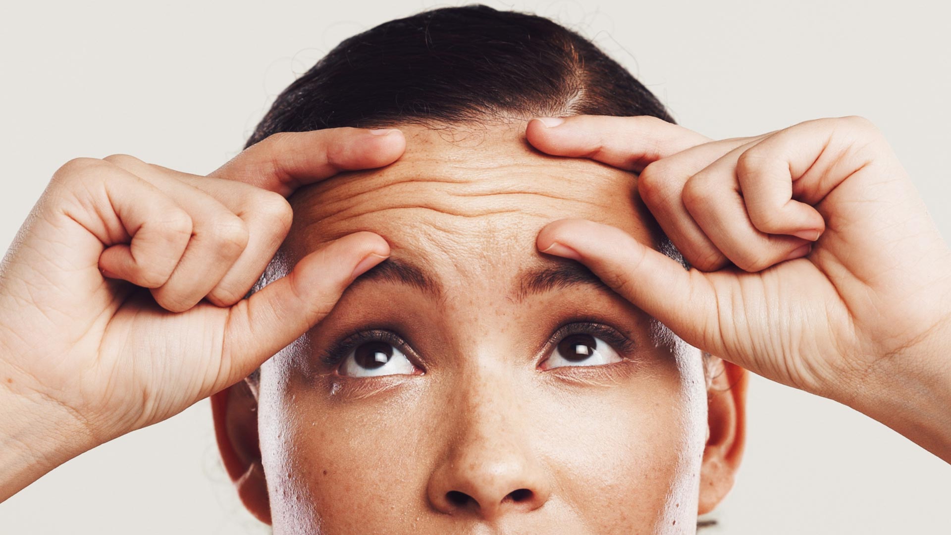 Amazin U - Forehead Lines