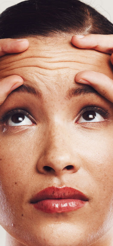 Amazin U - Forehead Lines