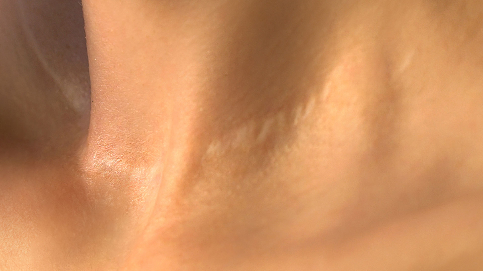 Amazin U - Stretch Marks & Scars