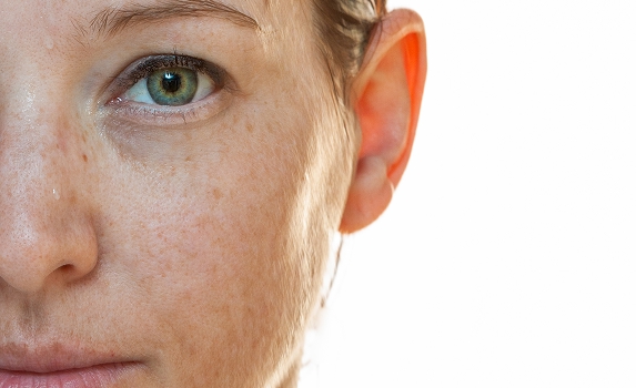 Amazin U - Skin Booster Package 8